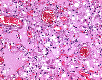 Paraffin pastilles, 56-58, Histology